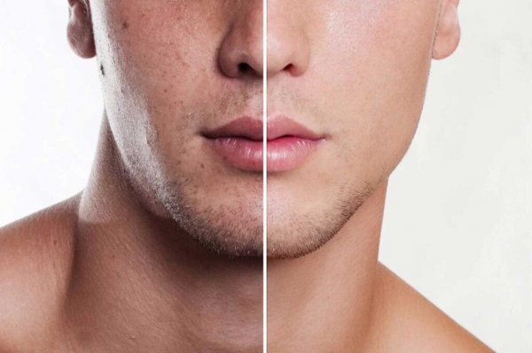Уход за мужской кожей лица: секреты здоровья и привлекательности
